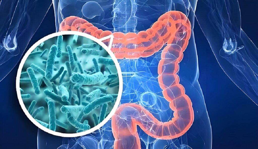 E. coli affecting food safety and leading to disease