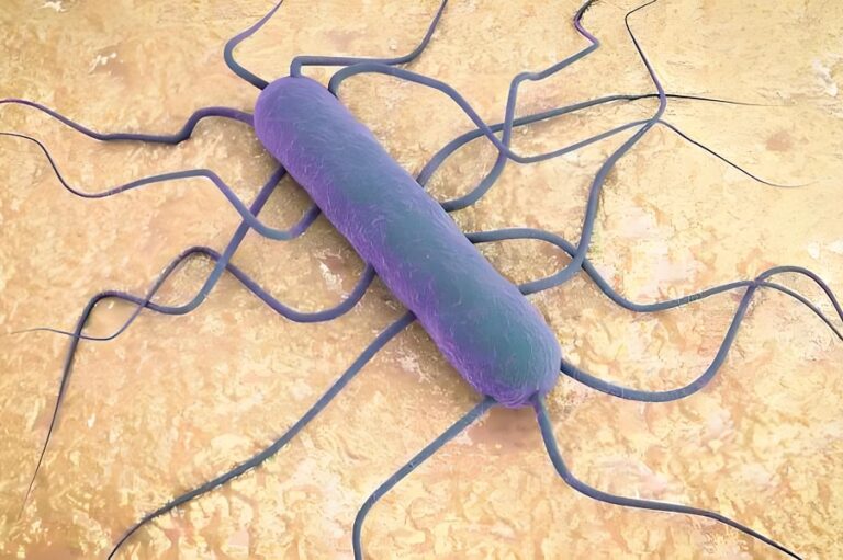 Listeria Challenges in the Food Industry